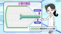 Dr.長尾の胸部X線クイズ　上級編 | 第3回　肺紋理が濃く見える、その理由は？