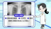 Dr.長尾の胸部X線クイズ　上級編 | 第6回　その所見がなぜあるか俯瞰的に考える