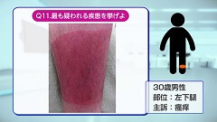 Dr.安部の皮膚科クイズ　初級編 | 第6回　赤くなるのはなぜ？