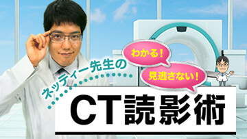 ネッティー先生のわかる！見逃さない！CT読影術